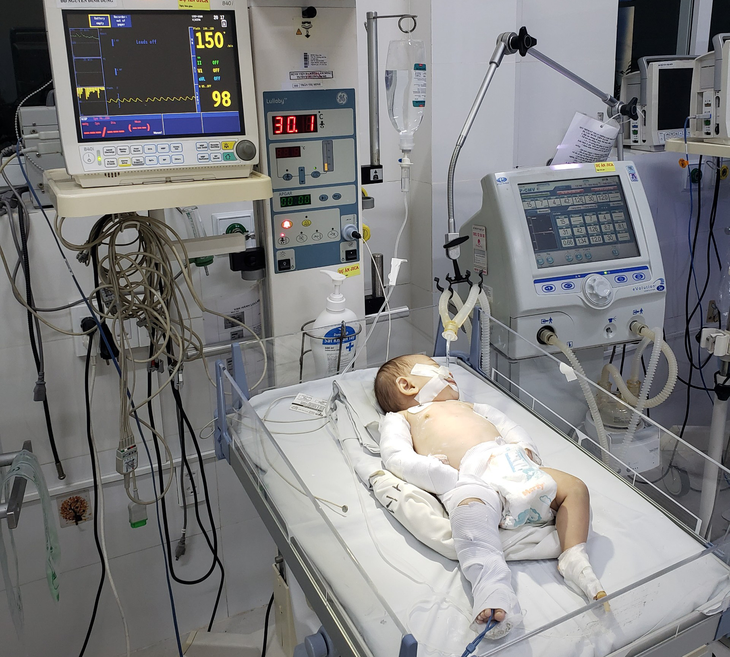 Bé 3 tháng tuổi bị hành hạ theo cách không thể tưởng tượng nổi - Ảnh 1. Bé 3 tháng tuổi bị hành hạ theo cách không thể tưởng tượng nổi - Ảnh 1.